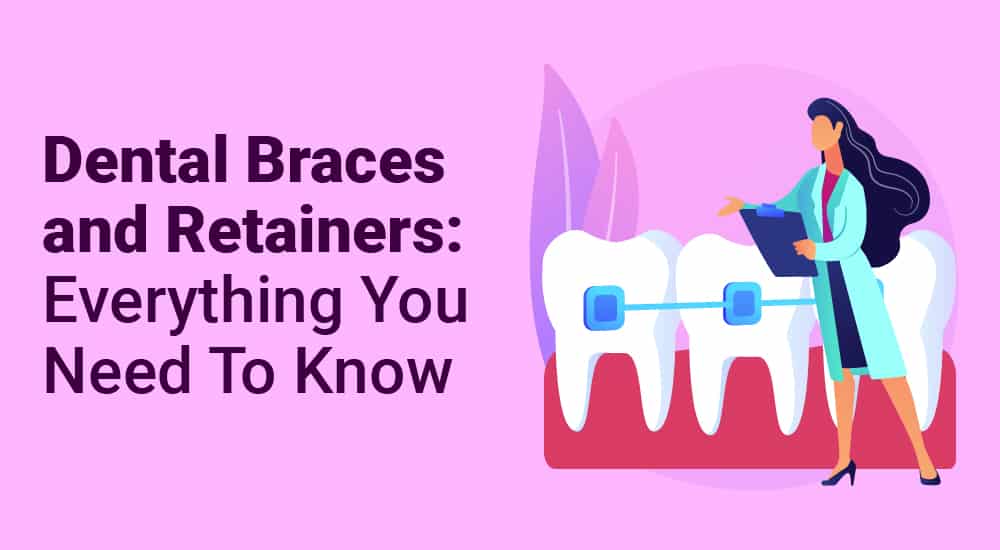 Dental Braces and Retainers Everything You Need To Know