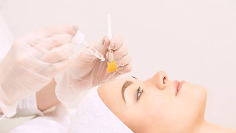 chemical peel